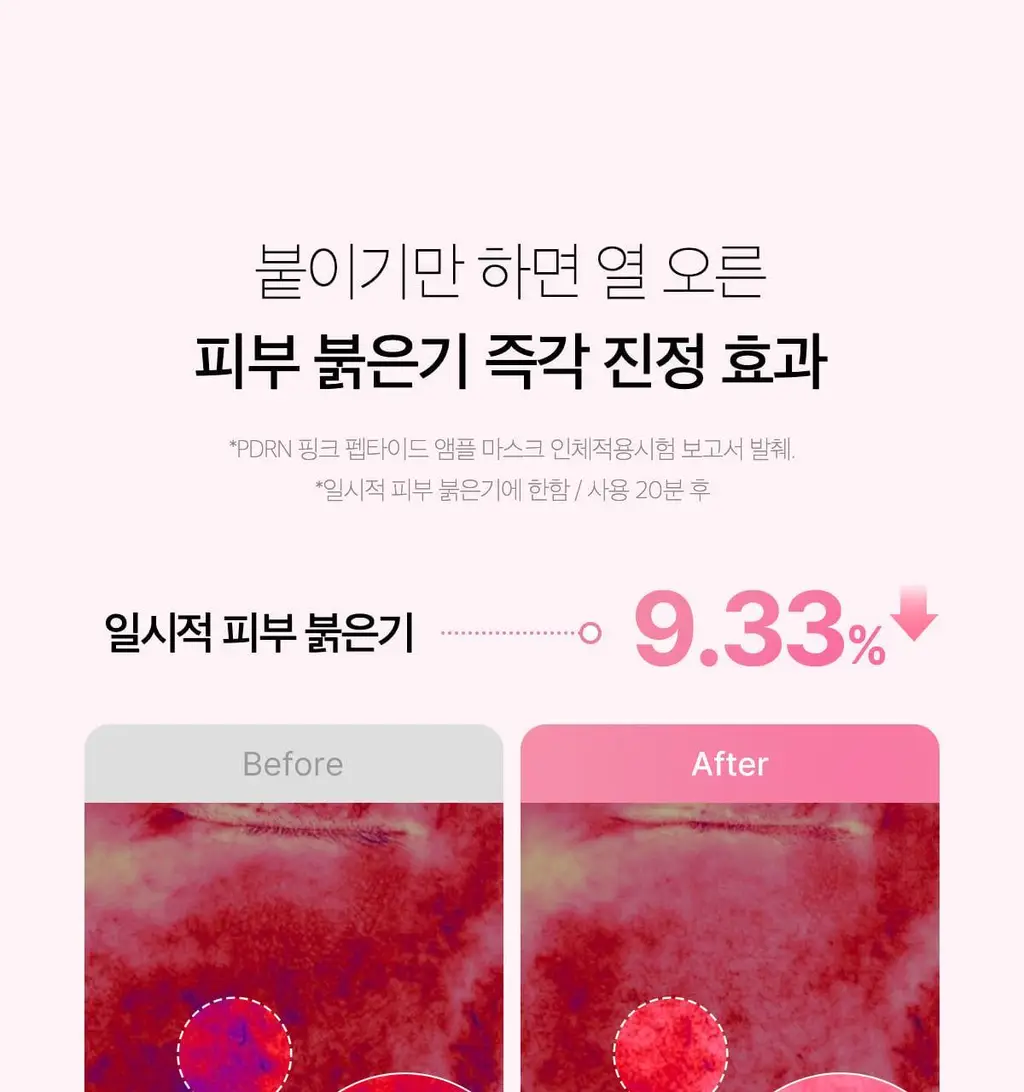 [NEW/5+1매 단독기획] 메디큐브 PDRN 핑크 펩타이드 앰플 마스크 5매 기획 (+1매) 상세페이지 33